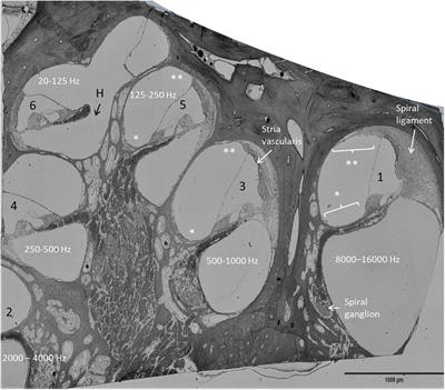 GJB2 and GJB6 gene transcripts in the human cochlea: A study using RNAscope, confocal, and super-resolution structured illumination microscopy